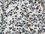 HuC Antibody in Immunohistochemistry (Paraffin) (IHC (P))