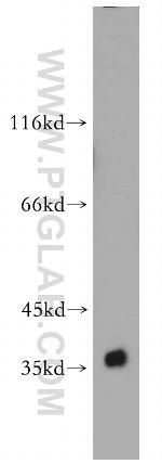 HuC Antibody in Western Blot (WB)