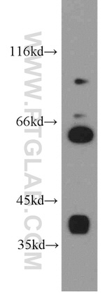 HuC Antibody in Western Blot (WB)
