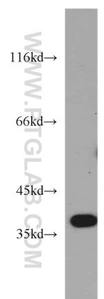 B3GALT6 Antibody in Western Blot (WB)