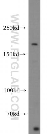 NRXN1 Antibody in Western Blot (WB)