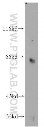 Toca 1 Antibody in Western Blot (WB)