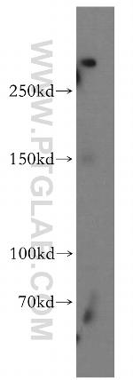 SHANK1 Antibody in Western Blot (WB)