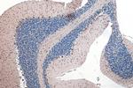 MAP1A Antibody in Immunohistochemistry (Paraffin) (IHC (P))