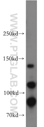 SORCS2 Antibody in Western Blot (WB)