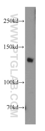 SORCS2 Antibody in Western Blot (WB)
