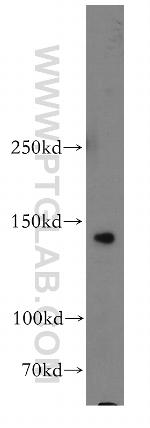 SORCS2 Antibody in Western Blot (WB)