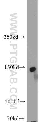 ADCY8 Antibody in Western Blot (WB)
