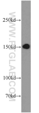 ADCY8 Antibody in Western Blot (WB)