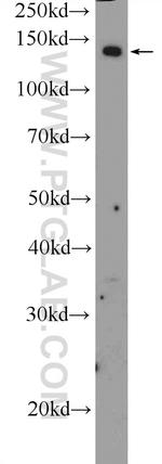 ADCY8 Antibody in Western Blot (WB)
