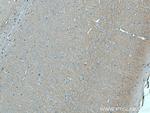 ADCY1 Antibody in Immunohistochemistry (Paraffin) (IHC (P))