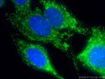 MTCO2 Antibody in Immunocytochemistry (ICC/IF)