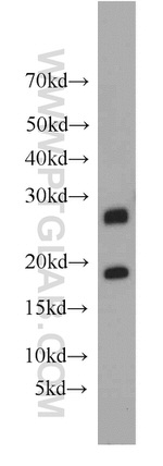 HLA-DQA2 Antibody in Western Blot (WB)