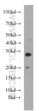 HLA-DQA2 Antibody in Western Blot (WB)