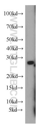 HLA-DQA2 Antibody in Western Blot (WB)