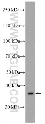 MTCO3 Antibody in Western Blot (WB)
