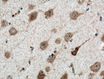 DRD2 Antibody in Immunohistochemistry (Paraffin) (IHC (P))