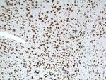 DRD2 Antibody in Immunohistochemistry (Paraffin) (IHC (P))