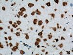 DRD2 Antibody in Immunohistochemistry (Paraffin) (IHC (P))