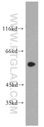 DRD2 Antibody in Western Blot (WB)