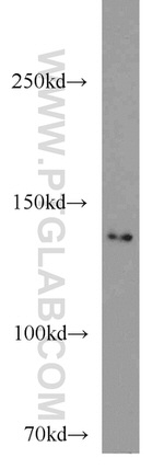 DLG1 Antibody in Western Blot (WB)