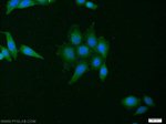 CYTB Antibody in Immunocytochemistry (ICC/IF)