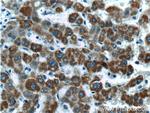 CYTB Antibody in Immunohistochemistry (Paraffin) (IHC (P))
