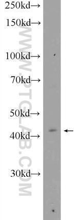 CYTB Antibody in Western Blot (WB)