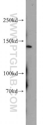 PTCH2 Antibody in Western Blot (WB)