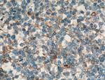 CR1 Antibody in Immunohistochemistry (Paraffin) (IHC (P))