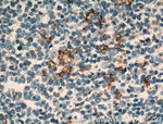 CR1 Antibody in Immunohistochemistry (Paraffin) (IHC (P))