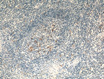 CR1 Antibody in Immunohistochemistry (Paraffin) (IHC (P))