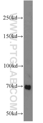 Frizzled 8 Antibody in Western Blot (WB)