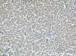 GDI2 Antibody in Immunohistochemistry (Paraffin) (IHC (P))