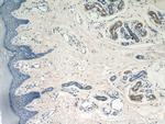 GDI2 Antibody in Immunohistochemistry (Paraffin) (IHC (P))