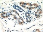 GDI2 Antibody in Immunohistochemistry (Paraffin) (IHC (P))