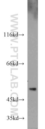 GDI2 Antibody in Western Blot (WB)