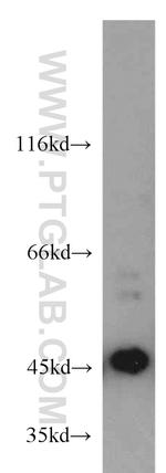 MAGEA1 Antibody in Western Blot (WB)