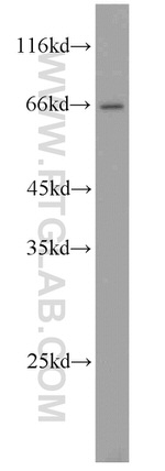 MEKK2 Antibody in Western Blot (WB)