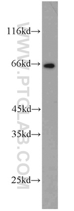 MEKK2 Antibody in Western Blot (WB)