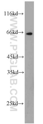 MEKK2 Antibody in Western Blot (WB)