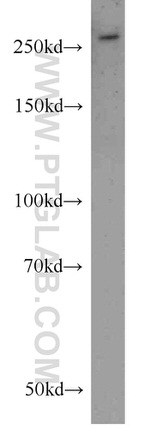 SPTBN2 Antibody in Western Blot (WB)