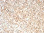 DOG-1/TMEM16A (Gastrointestinal Stromal Tumor Marker) Antibody in Immunohistochemistry (Paraffin) (IHC (P))