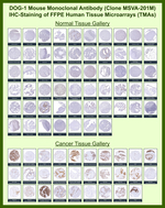 DOG-1/TMEM16A (Gastrointestinal Stromal Tumor Marker) Recombinant Mouse Monoclonal Antibody (MSVA-201M)