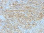 DOG-1/ANO1 (Marker for Gastrointestinal Stromal Tumors) Monoclonal Antibody (SPM580)