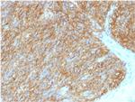 DOG-1/TMEM16A Monoclonal Antibody (DG1, 1486)