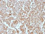 DOG-1/TMEM16A (Gastrointestinal Stromal Tumor Marker) Monoclonal Antibody (rDG1/447)