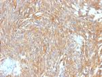 DOG-1/TMEM16A Recombinant Rabbit Monoclonal Antibody (DG1, 2564R)