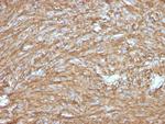 DOG-1/TMEM16A Recombinant Rabbit Monoclonal Antibody (DG1, 2831R)