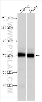 ATP13A3 Antibody in Western Blot (WB)